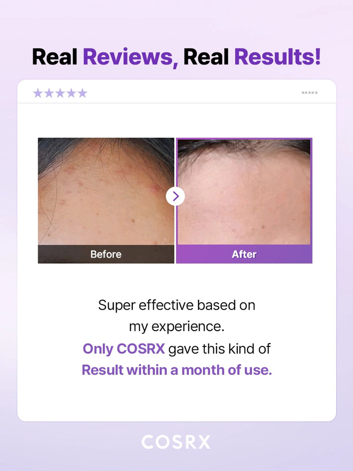 COSRX AHA/BHA Clarifying Treatment Toner | Korean Toners