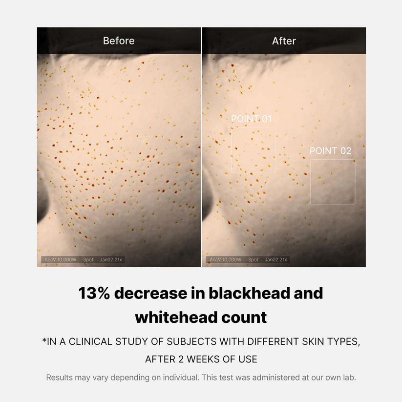 Medicube Zero Pore One-day Serum