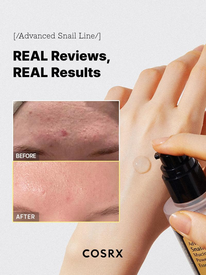 COSRX Advanced Snail 96 Mucin Power Essence | Korean Moisturizer