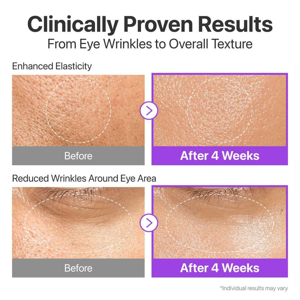Image showing clinically proven results of numbuzin No.9 NAD+ BIO Lifting-sil Essence for skin texture improvement.