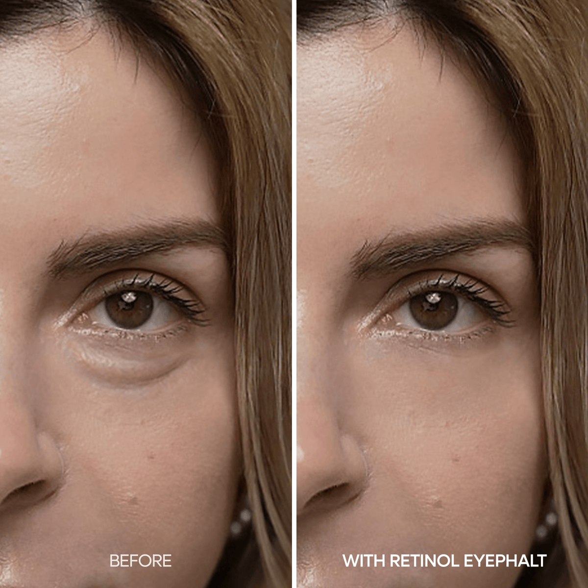 Dr. Melaxin Eyephalt Retinal Eyebag Cream | Korean Eye Cream before and after results on under-eye bags
